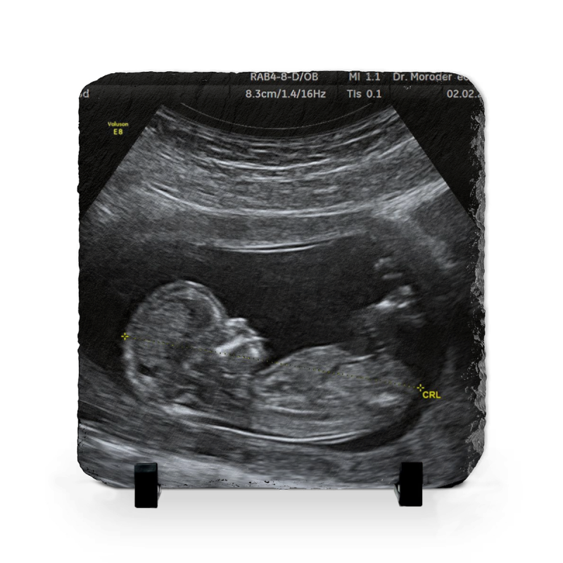 Personalized Ultrasound Photo Slate, Custom Sonogram Keepsake, Pregnancy Announcement Gift, Expecting Parents Gift